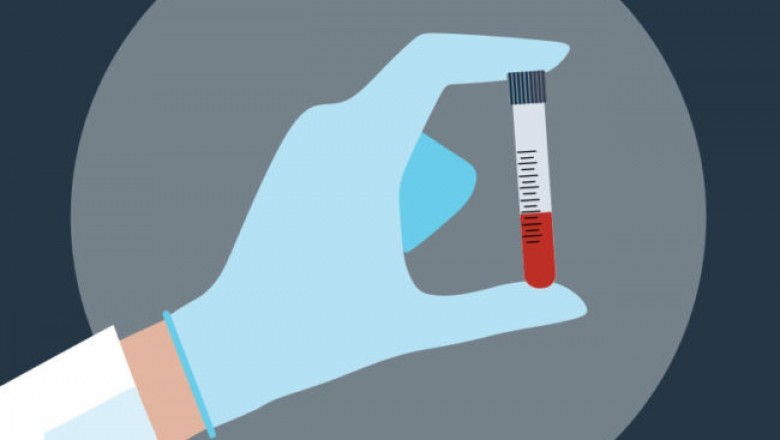 Jak najlepiej sprawdzić swój poziom cholesterolu oraz ryzyko związane z zaburzeniami układu naczyniowego?