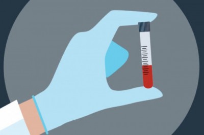 Jak najlepiej sprawdzić swój poziom cholesterolu oraz ryzyko związane z zaburzeniami układu naczyniowego?