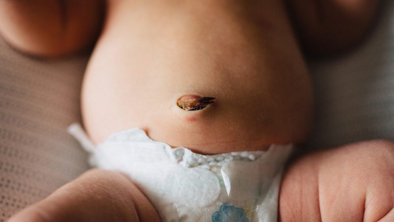 Jak pielęgnować pępek niemowlaka?