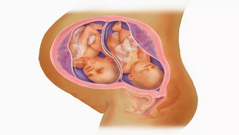 Jestem w ciąży wielopłodowej(bliźniaczej). Czym będzie się ona różnić od pojedynczej?