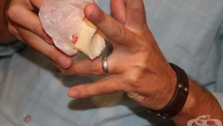 Jak zdjąć pierścionek ze spuchniętego palca - domowym sposobem.