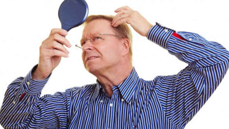 Co zrobić aby powstrzymać łysienie? Czy łysienie jest odwracalne? Jak zapobiec łysieniu w młodym wieku?
