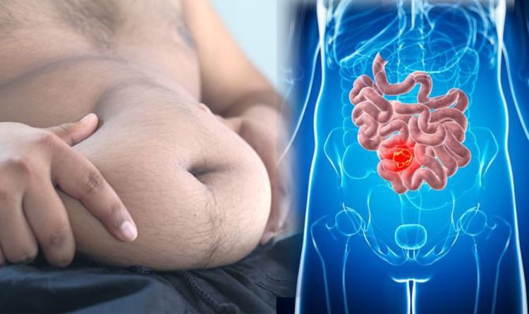 Otyłość zagrożeniem większym niż palenie