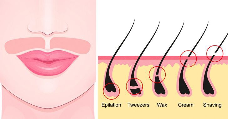 Jak pozbyć się niechcianych włosków z twarzy