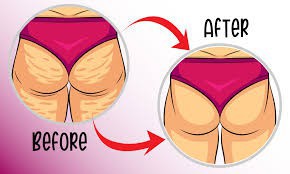 Domowe sposoby na pozbycie się cellulitu