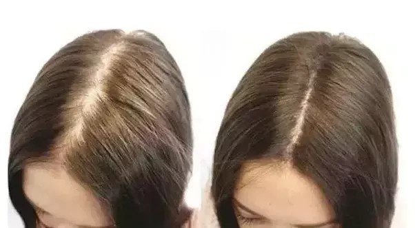 Jak przyspieszyć wzrost włosów? Tani, domowy, skuteczny środek na porost włosów.