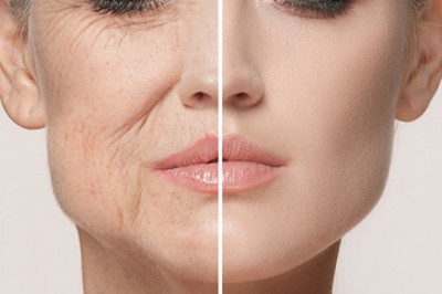 5 oznak starzenia się skóry.