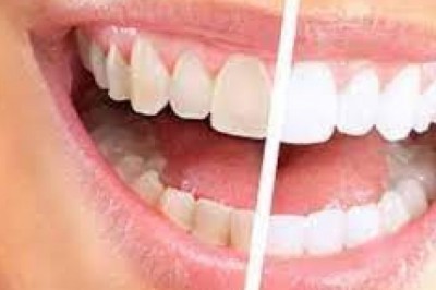 Prosty domowy sposób na wybielenie zębów.