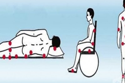 Domowe i naturalne kuracje (sposoby) na odleżyny.