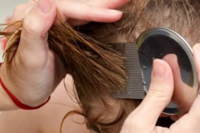 Jak szybko i skutecznie pozbyć się wszy domowym sposobem?