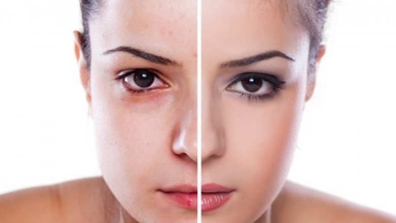 Czy da się zmienić kształt twarzy, czyli wszystko o rzeźbieniu rysów twarzy?