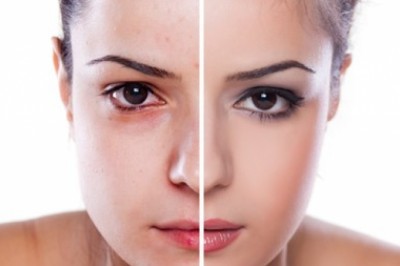 Czy da się zmienić kształt twarzy, czyli wszystko o rzeźbieniu rysów twarzy?