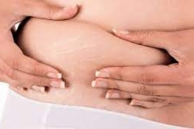 Najlepszy peeling na rozstępy, czyli co jest skuteczne na rozstępy?