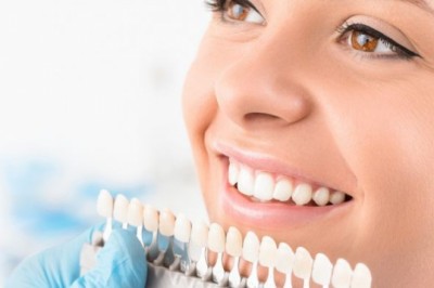 Domowe sposoby na wybielanie zębów.