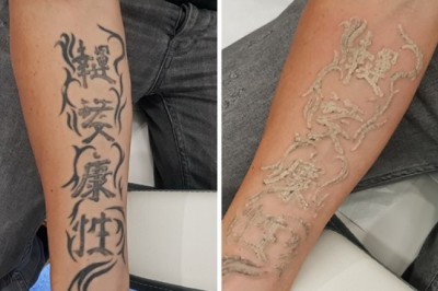 Jak pozbyć się tatuażu?